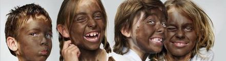 Blackface for UNICEF